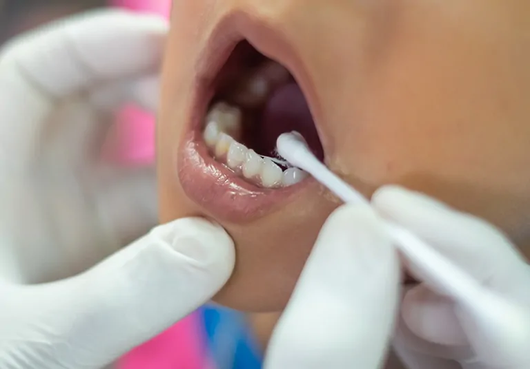 Why Fluoride Treatment Is Good For Your Teeth